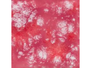 CG 968 Peppermint Twist