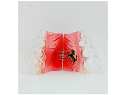 Expansor rapido de Arceguet