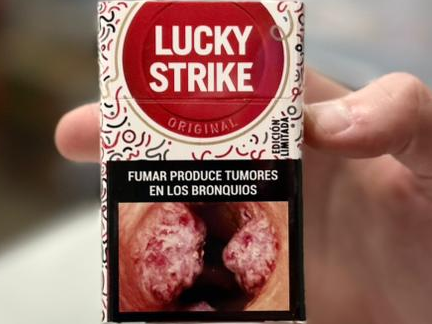 Lucky comun box x20