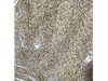 QUINOA BLANCA x 1k