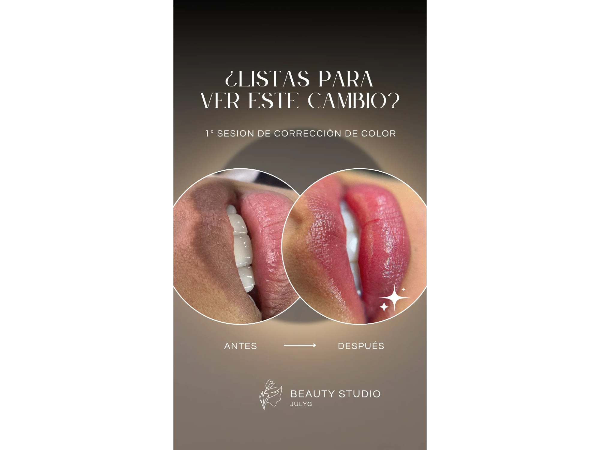 Neutralizacion de labios