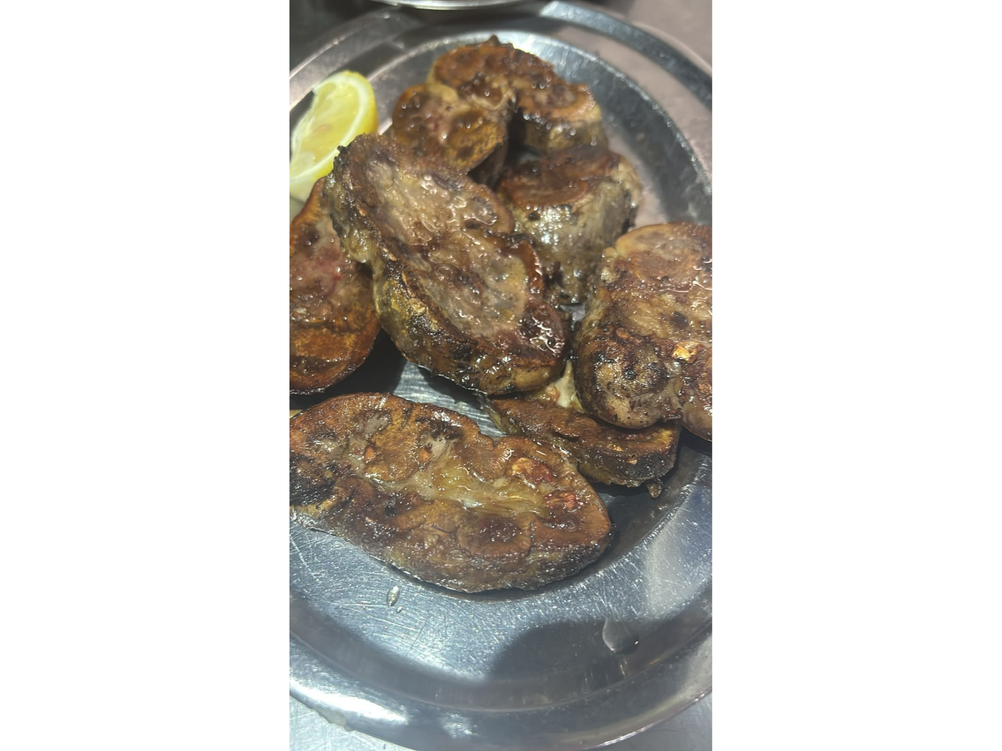Riñones