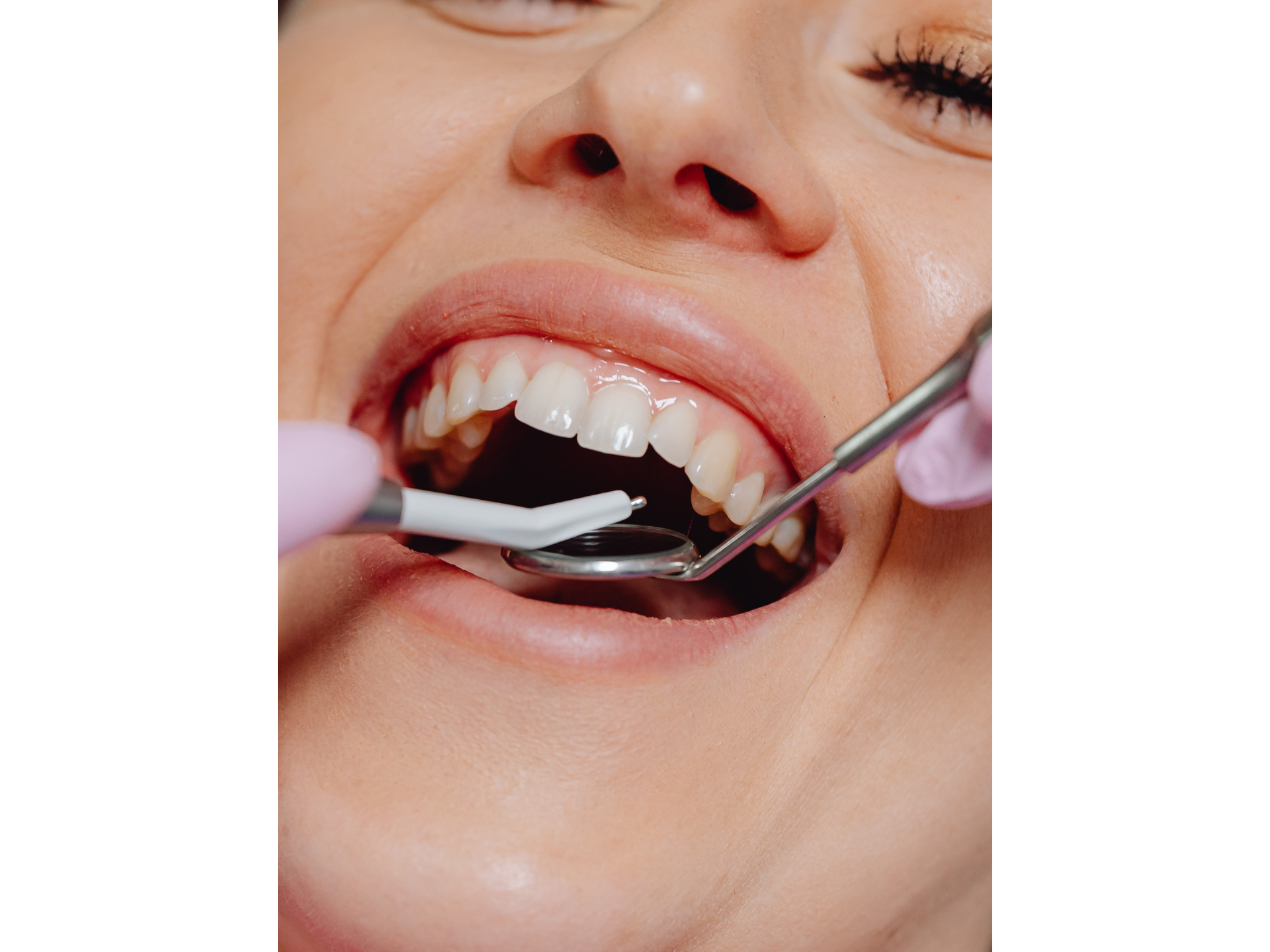 Seguimiento de tratamiento