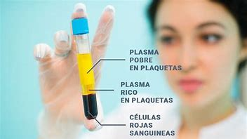 PLASMA RICO EN PLAQUETAS / FIBRINA