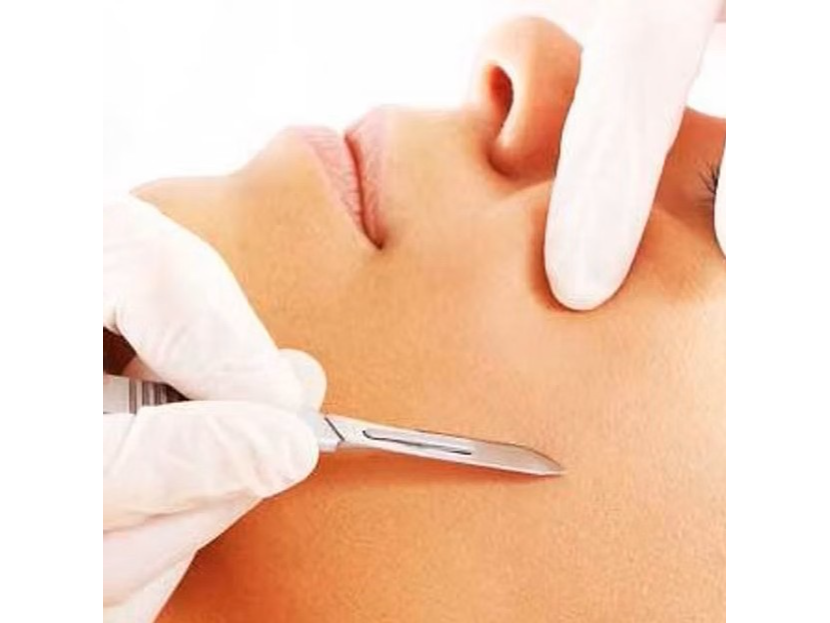 Kit Dermaplaning: 100 Hojas bisturi N°10 y 1 mango N°3