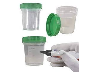 frasco de urocultivo esteril para analisis