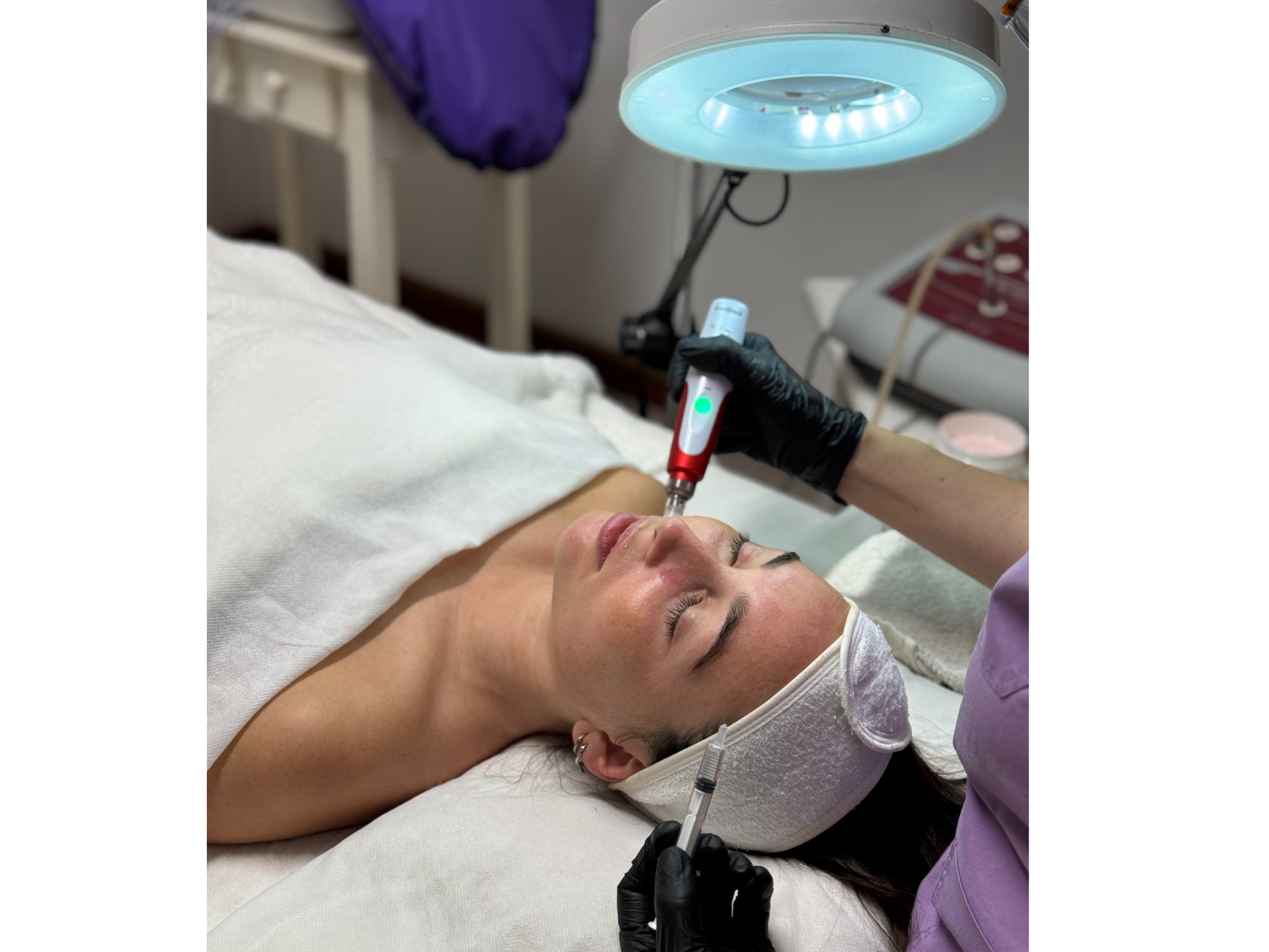 Limpieza Facial con Microneedling 1 H 15 MIN