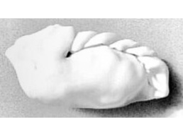 Queso, panceta y ciruela