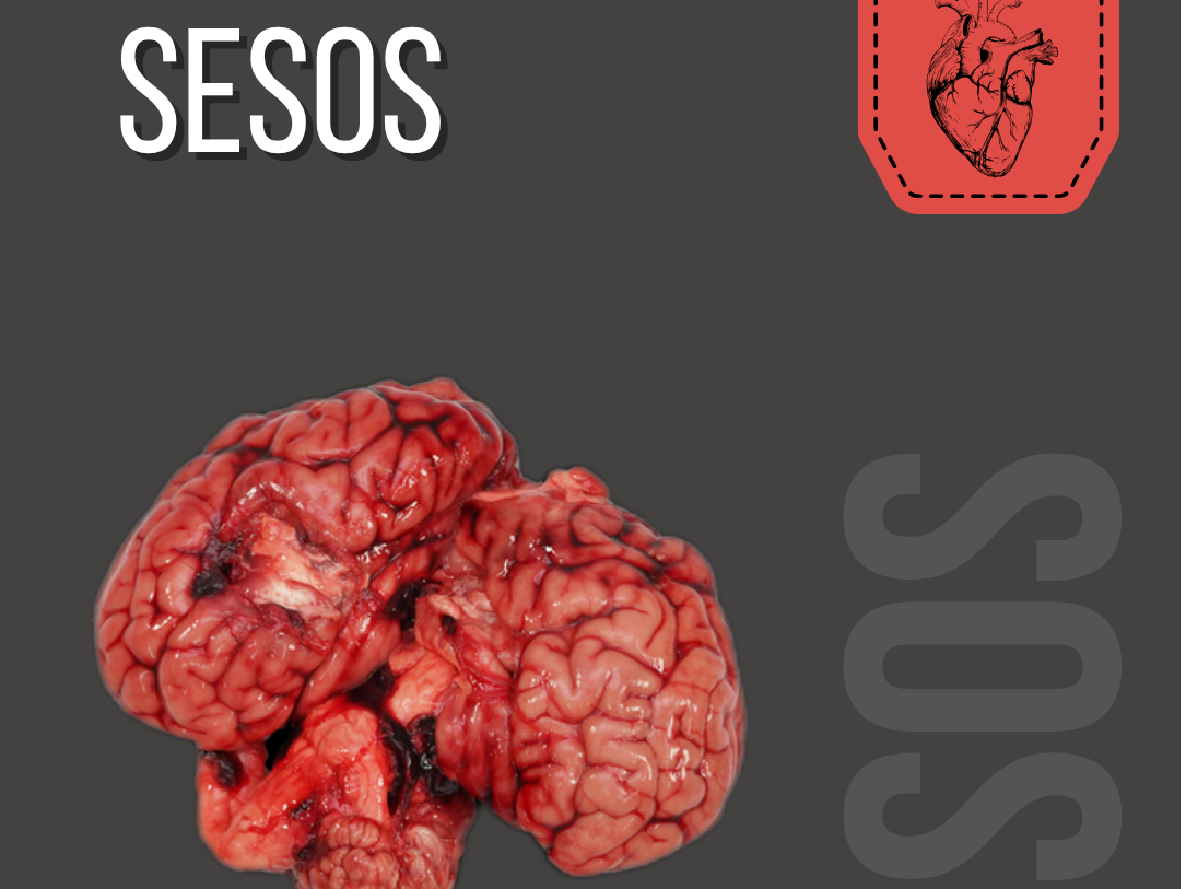 Sesos