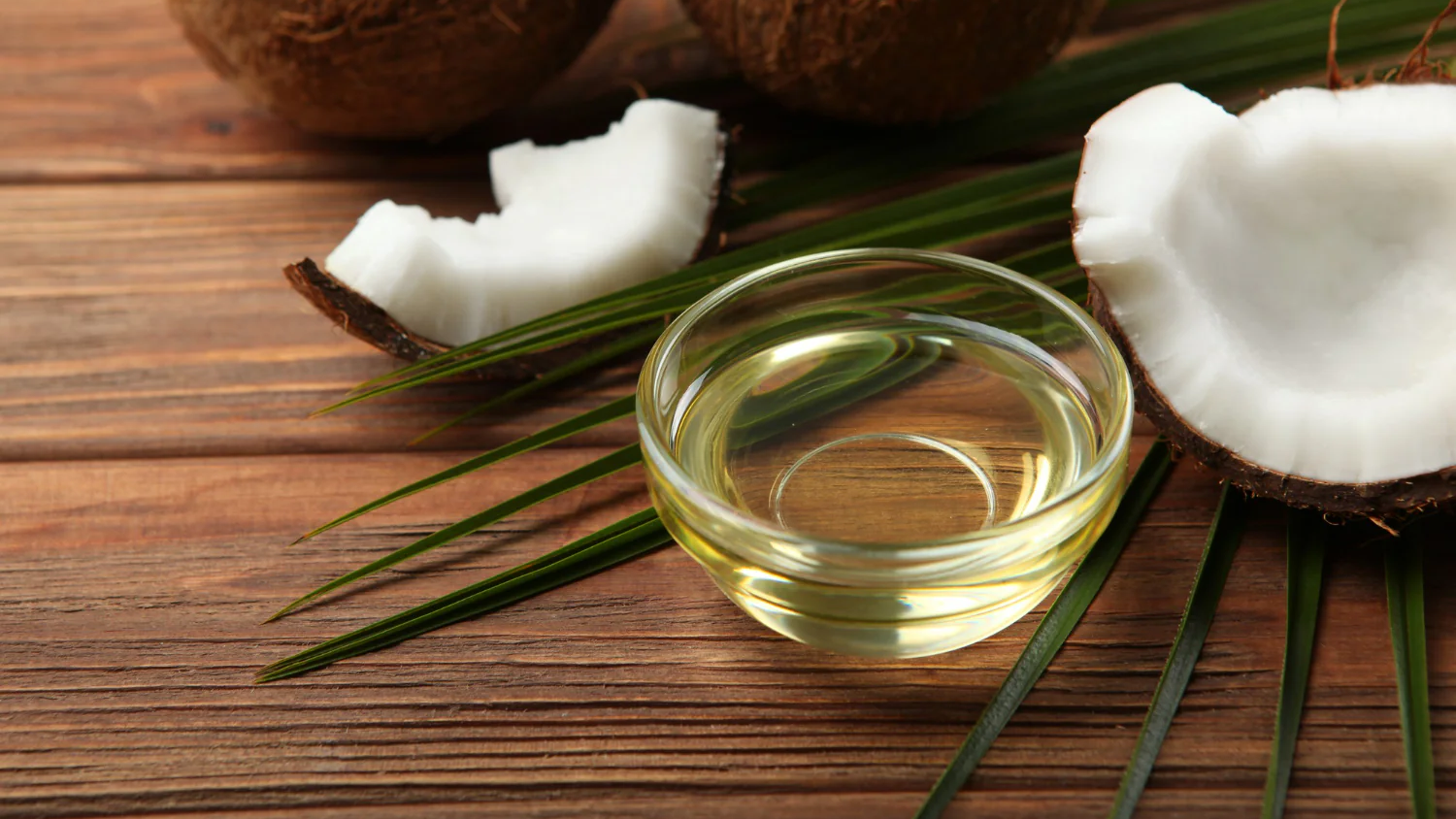 ACEITES