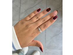 Anillo