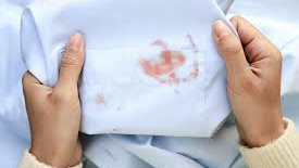 QUITAMANCHAS Y PRELAVADOS